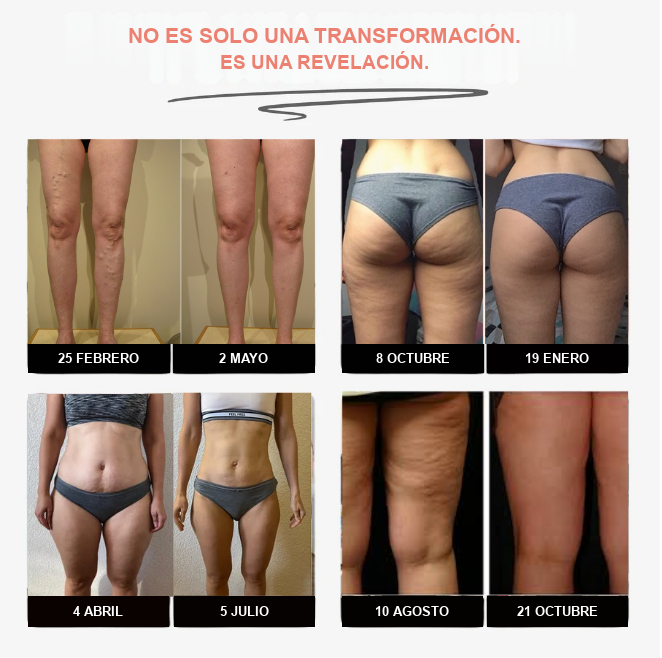 Leggings Fittabella 3D: redefine tu silueta sin esfuerzo. + GUIA GRATIS PARA EL CUIDADO DE LA PIEL