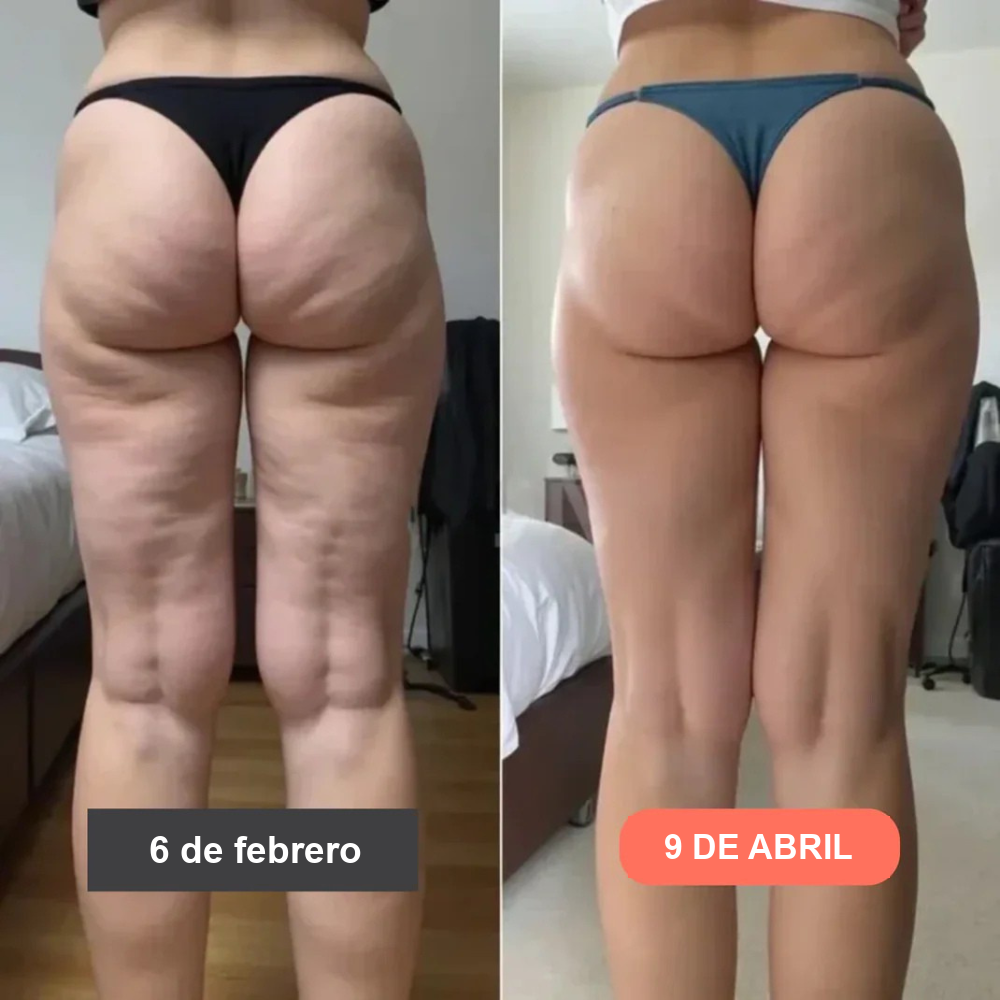 Leggings Fittabella 3D: redefine tu silueta sin esfuerzo. + GUIA GRATIS PARA EL CUIDADO DE LA PIEL
