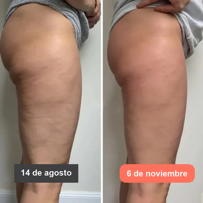 Leggings Fittabella 3D: redefine tu silueta sin esfuerzo. + GUIA GRATIS PARA EL CUIDADO DE LA PIEL